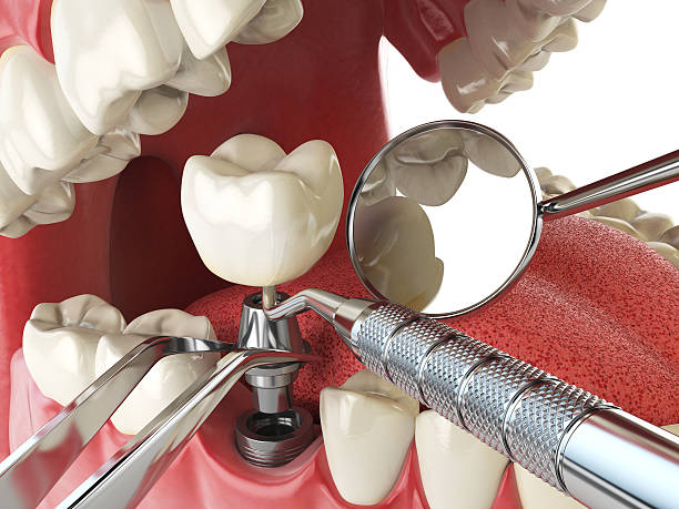 Best After-Hours Emergency Dentist in Spring Lake, MI